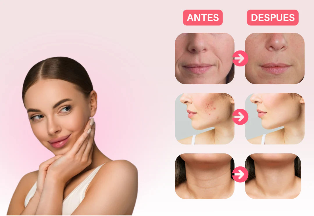 💆‍♀️ Masajeador Facial Anti-Edad – Piel Joven Sin CirugĂas